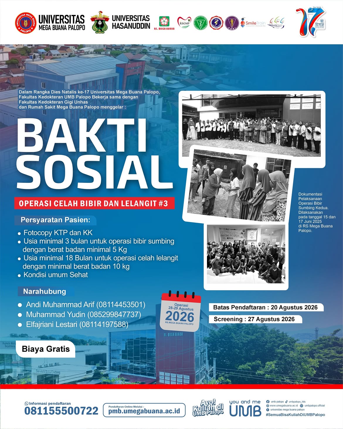 Sambut Dies Natalis ke-17 UMB Palopo, RS Mega Buana Gelar Operasi Celah Bibir dan Lelangit Gratis #3
